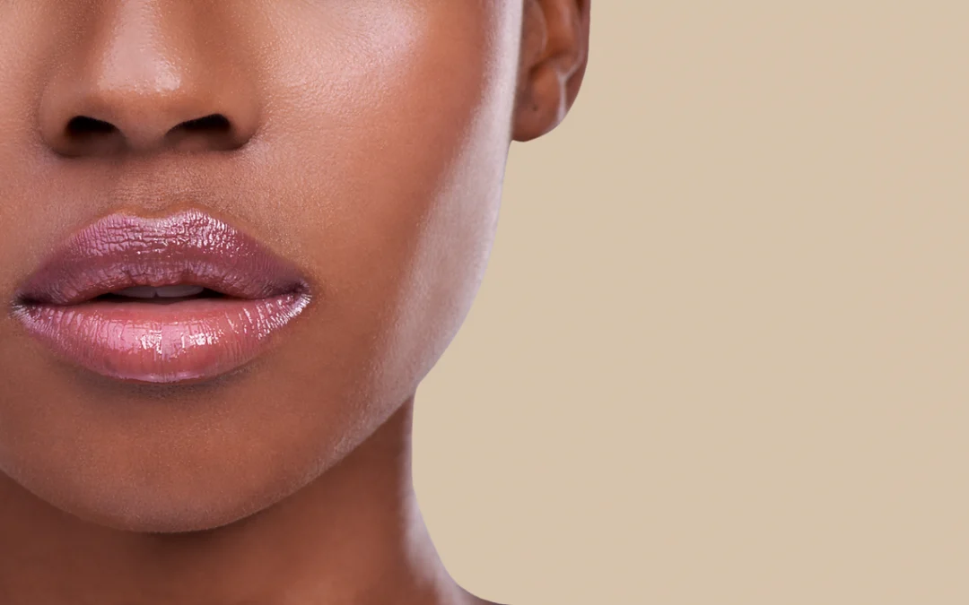 Everything you need to know about Lip Fillers