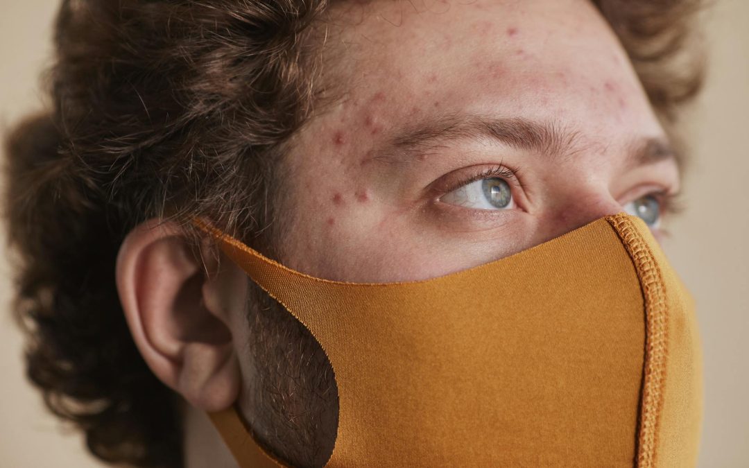 How do you clear up Rosacea?
